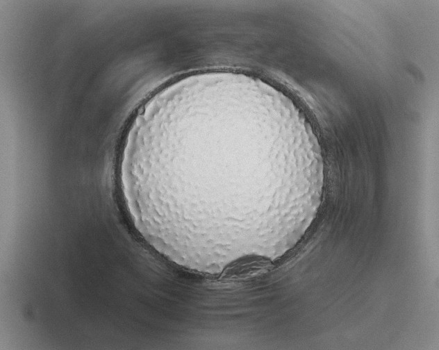 X0000116421415201001051117