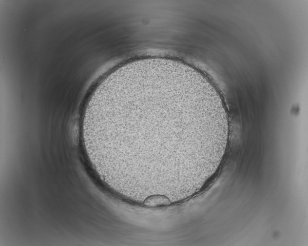 X0000116420016201001191459