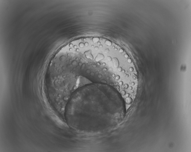 X0000116420145201001191457