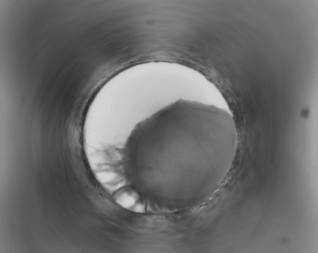 X0000116420146201001191457