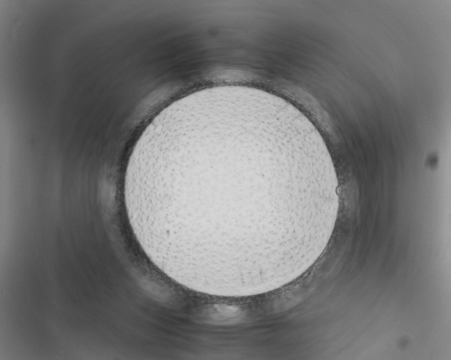X0000116420159201001191457