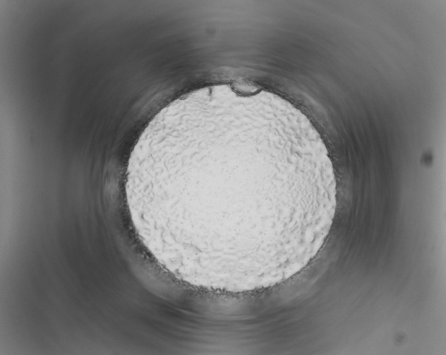 X0000116420166201001191457