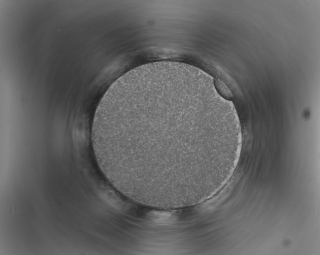 X0000116420170201001191457