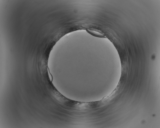 X0000116420186201001191457