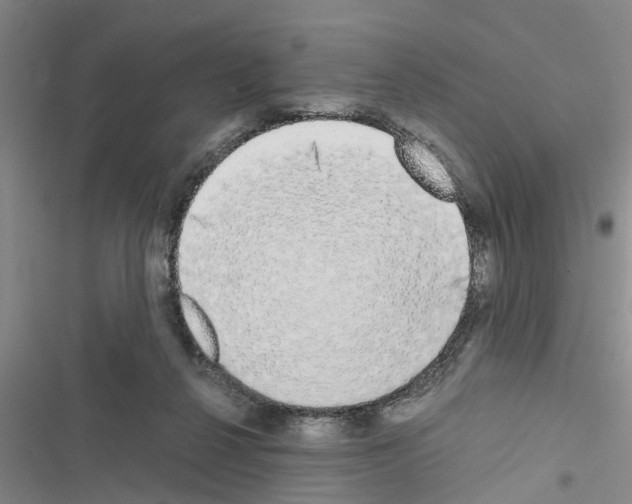 X0000116420264201001191456