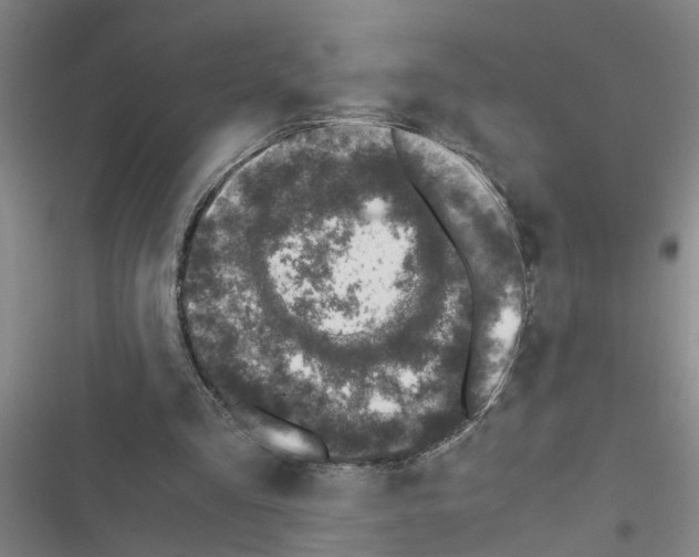 X0000116420293201001191456