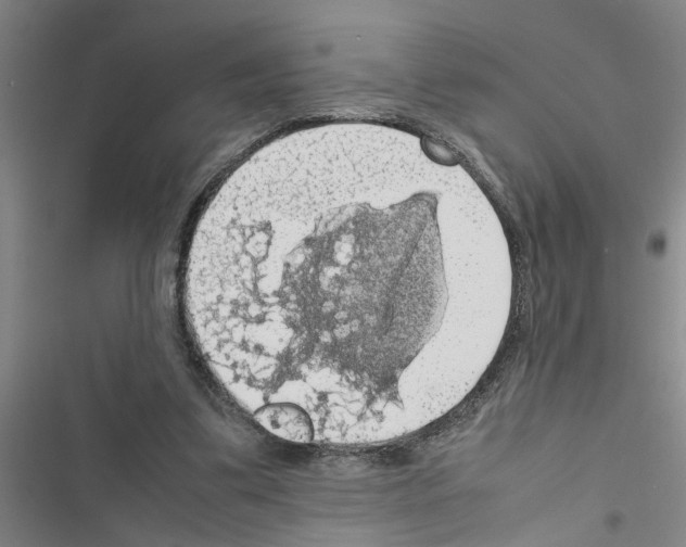 X0000116420299201001191455