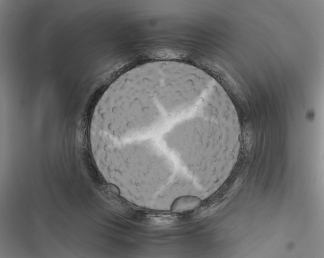 X0000116420359201001191455