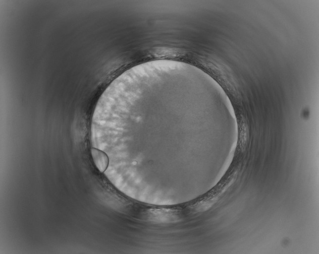 X0000116420367201001191455