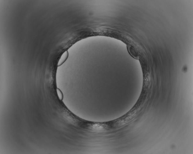 X0000116420566201001191452