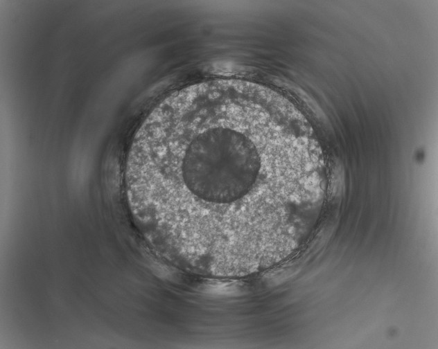 X0000116420569201001191452