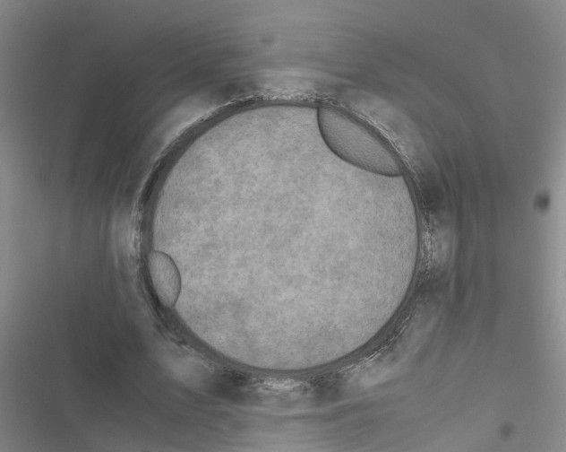 X0000116420583201001191452