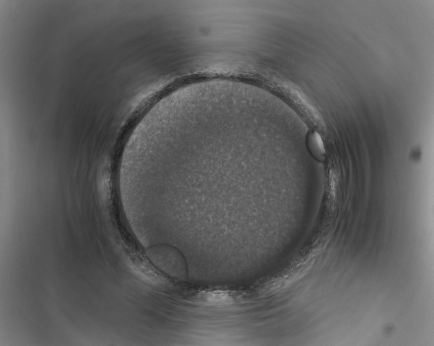 X0000116420588201001191452