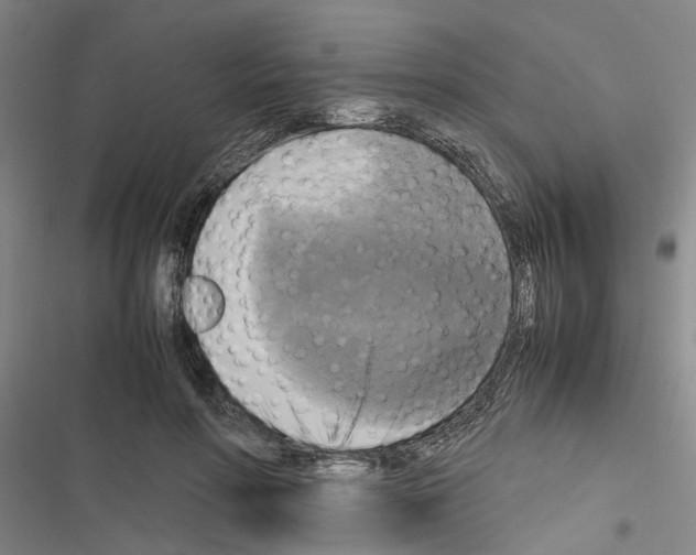 X0000116420598201001191451