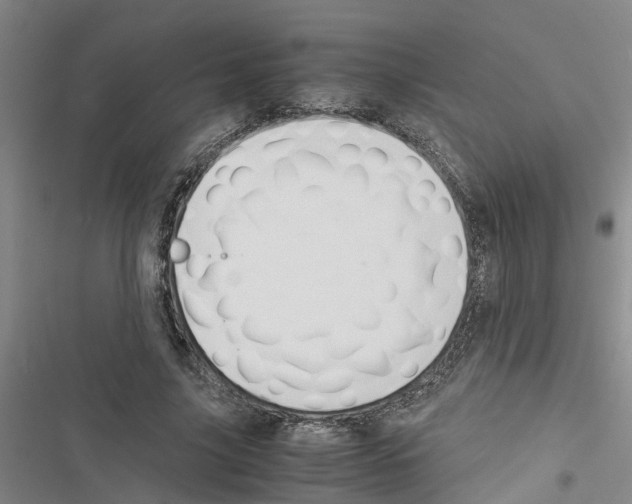 X0000116420635201001191451