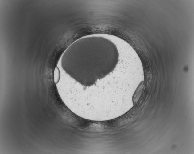 X0000116420699201001191450