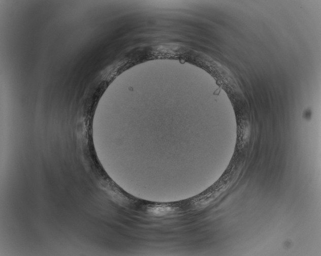X0000116420759201001191450