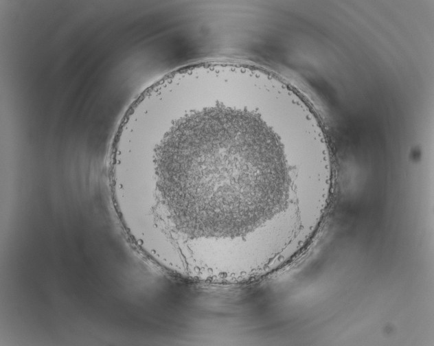 X0000116420856201001191448