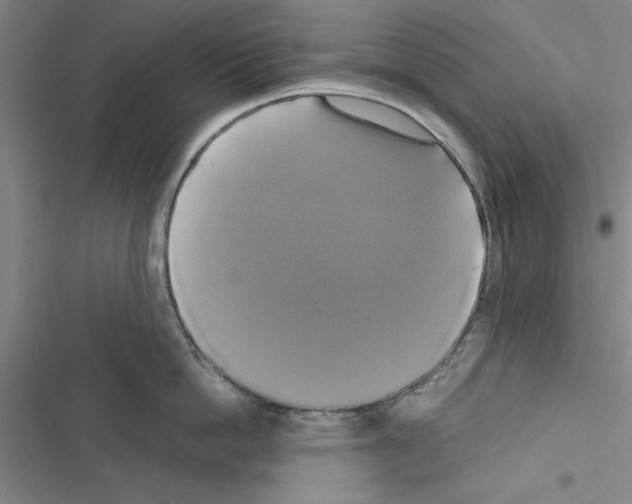 X0000116420862201001191448