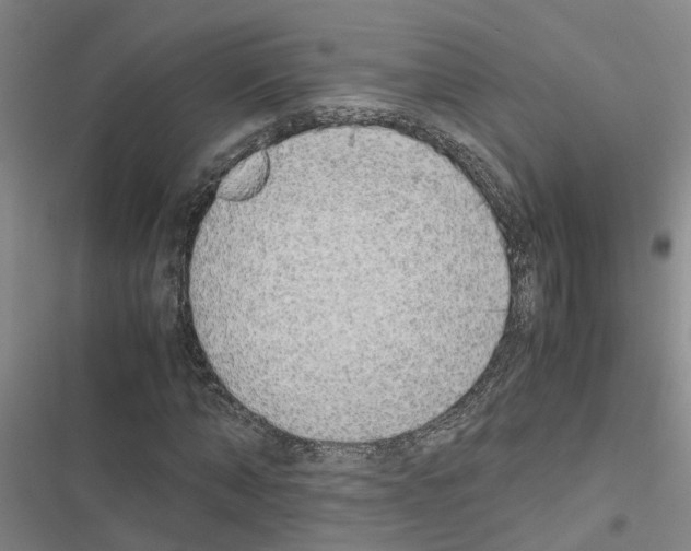 X0000116420870201001191448