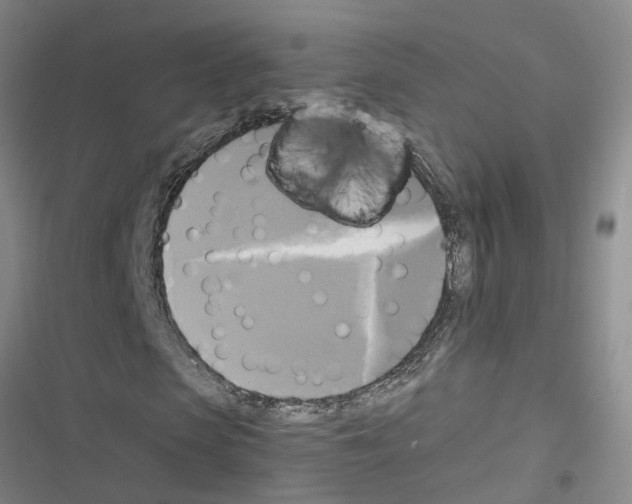 X0000116420913201001191446