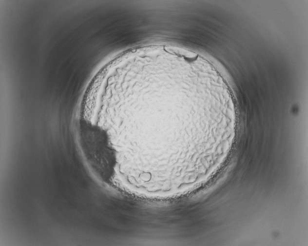 X0000116420957201001191447