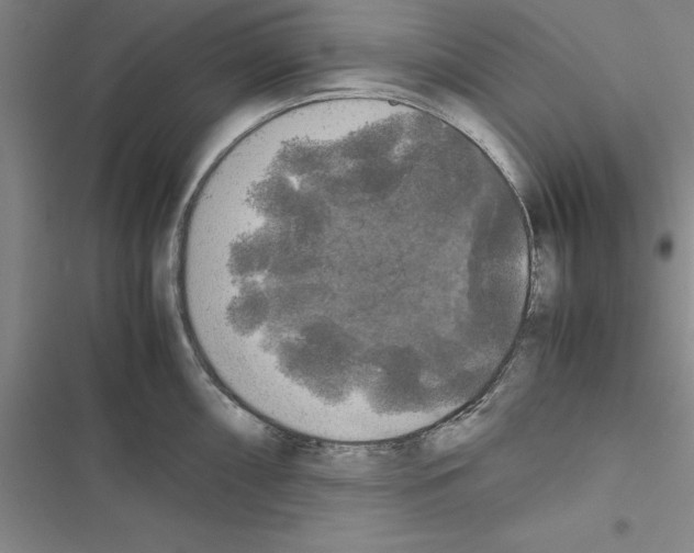 X0000116421098201001191445