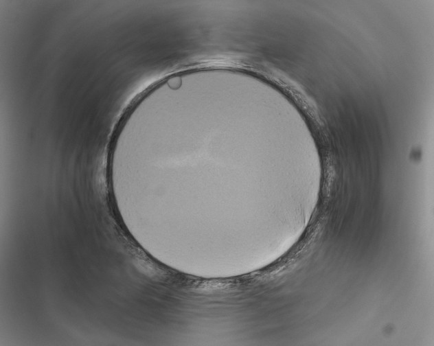 X0000116421174201001191444