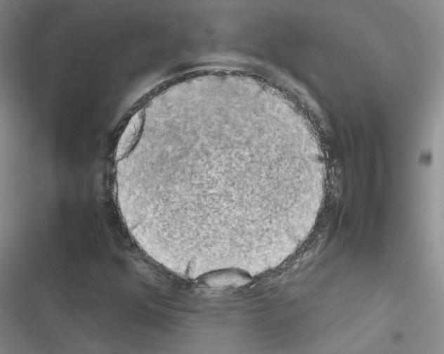 X0000116421352201001191441