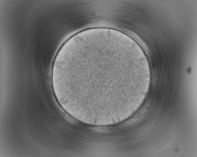 X0000116421388201001191441