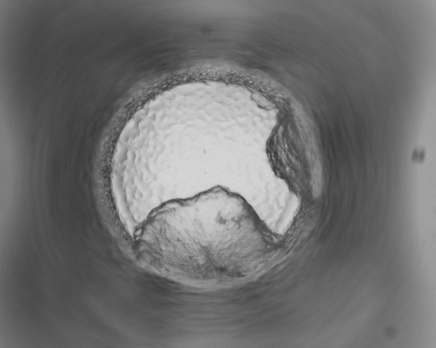 X0000116421393201001191440