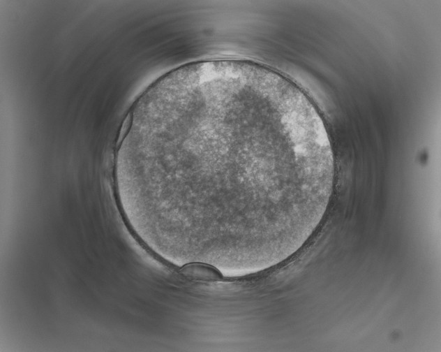 X0000116421476201001191439