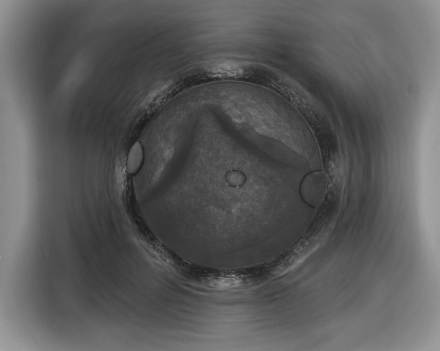 X0000116430600200912151020