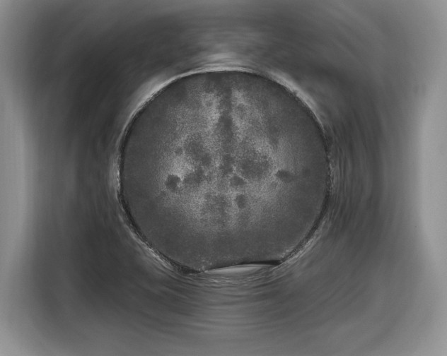 X0000116431415200912151009