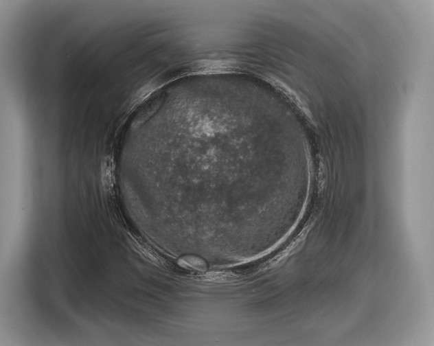 X0000116431449200912151009