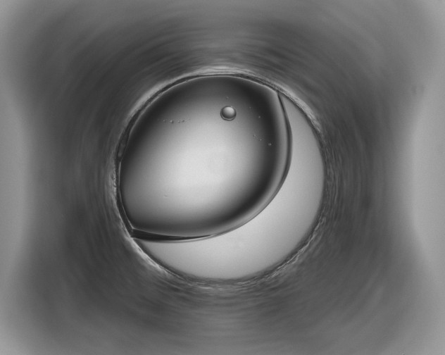 X0000116431476200912151008
