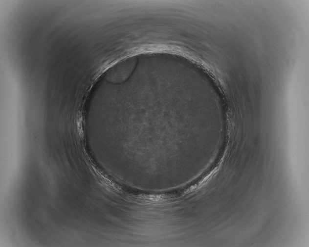 X0000116431497200912151008