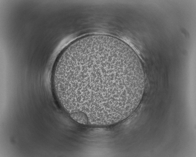 X0000116430151201001051152