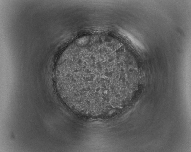 X0000116430913201001051142
