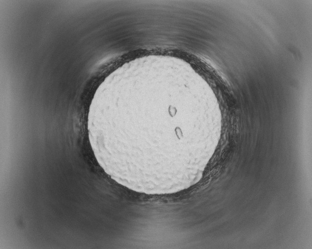X0000116431063201001051141