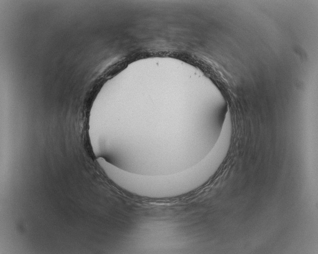 X0000116431157201001051140