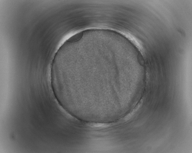 X0000116431382201001051137