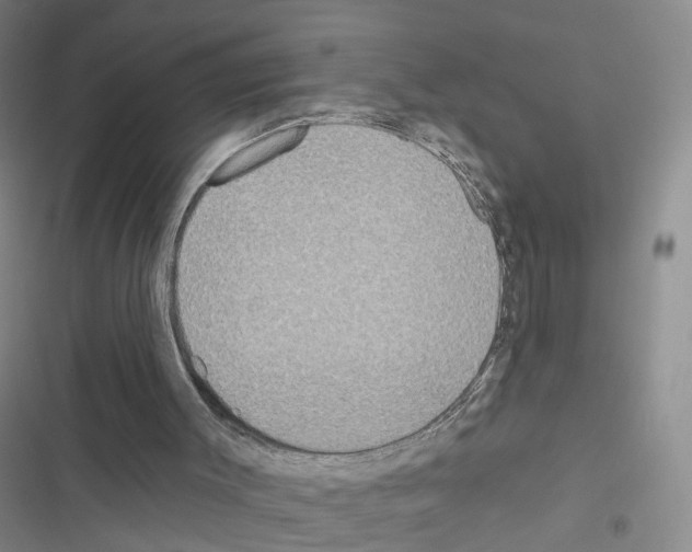 X0000116430003201001191520