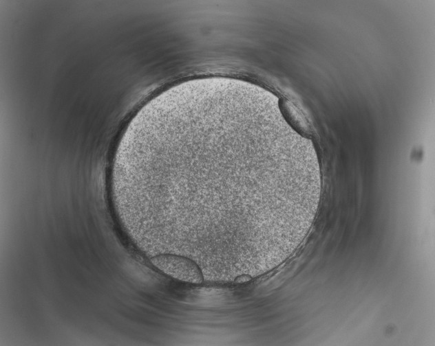 X0000116430154201001191518