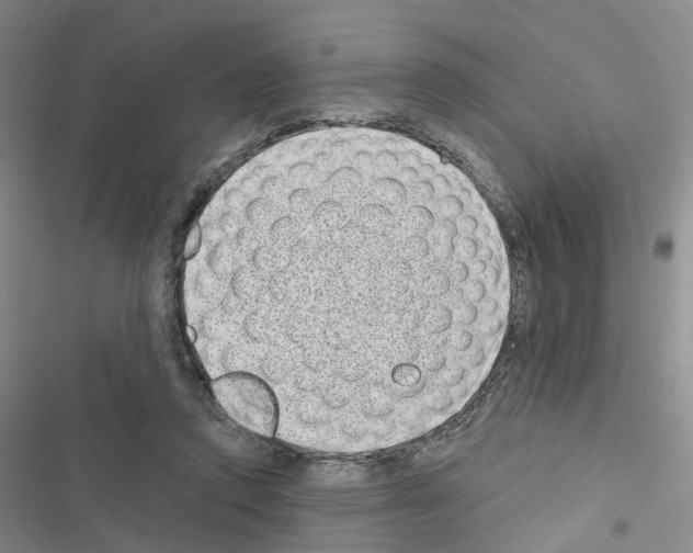 X0000116430354201001191515