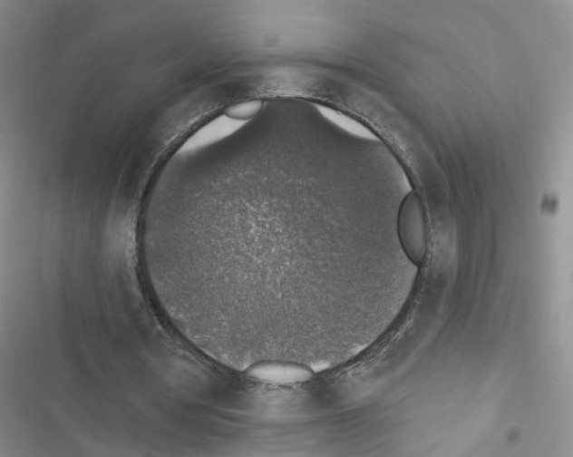 X0000116430386201001191515