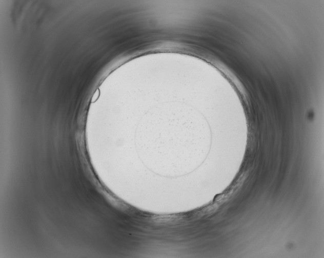 X0000116431437201001191501