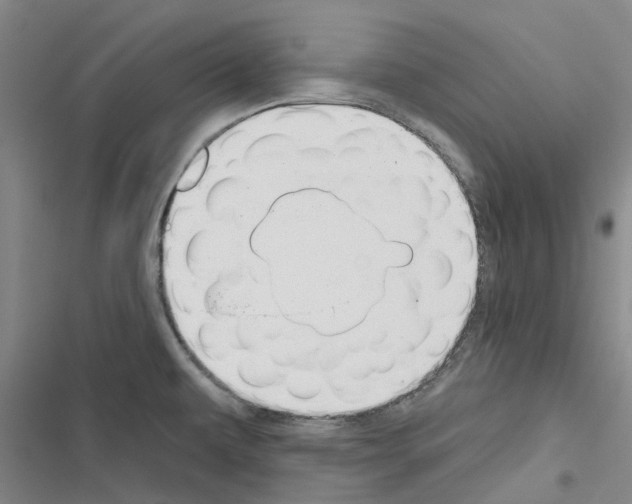 X0000116431479201001191500