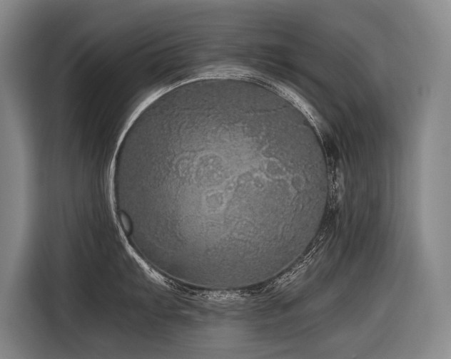 X0000116441103200912081551