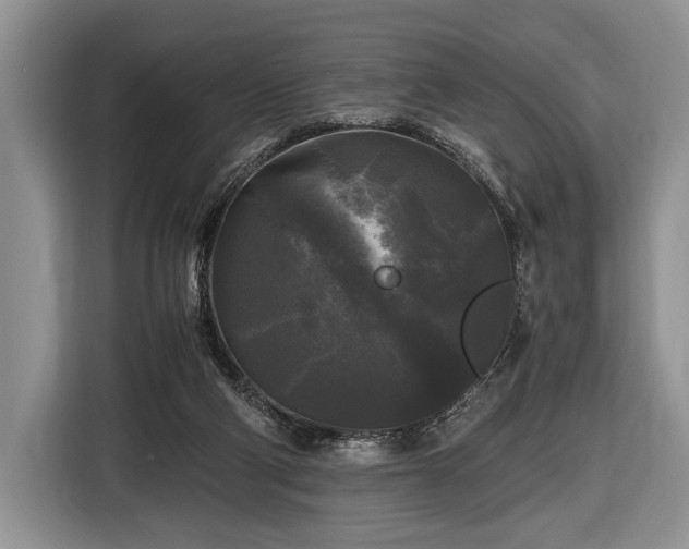 X0000116440114200912151248